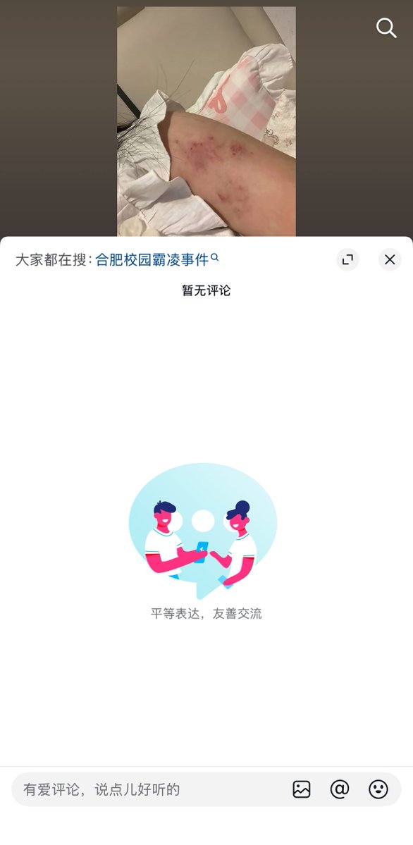 Attached Image
